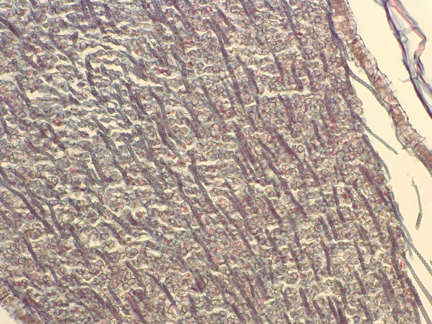 Liverwort Sporophyte Slides - Liverwort Sporophyte 02 200X